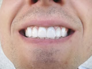 Patient smile after cosmetic treatment with Dr. Marshall